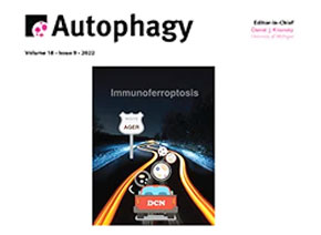 「輝駿客戶文章」Autophagy | 發(fā)現MIR516A在人類膀胱癌中的獨特作用